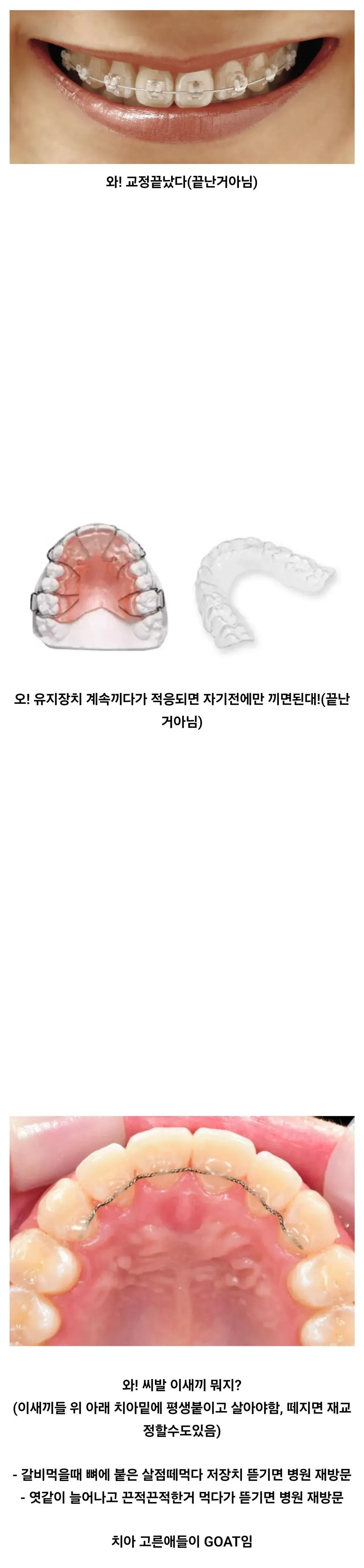 교정 끝난 줄 알았는데 끝난 거 아님.jpg